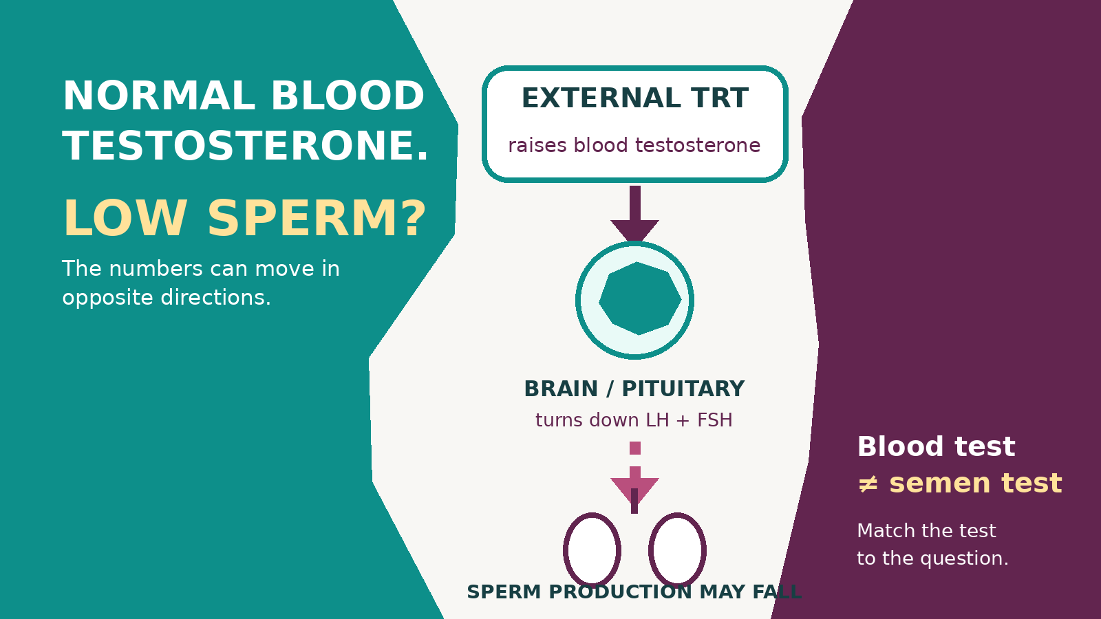 Diagram showing external testosterone raising blood levels while reducing LH and FSH signals from the brain to the testes